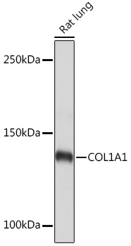 COL1A1 polyclonal antibody-Primary Antibodies-Bioworld Technology 
